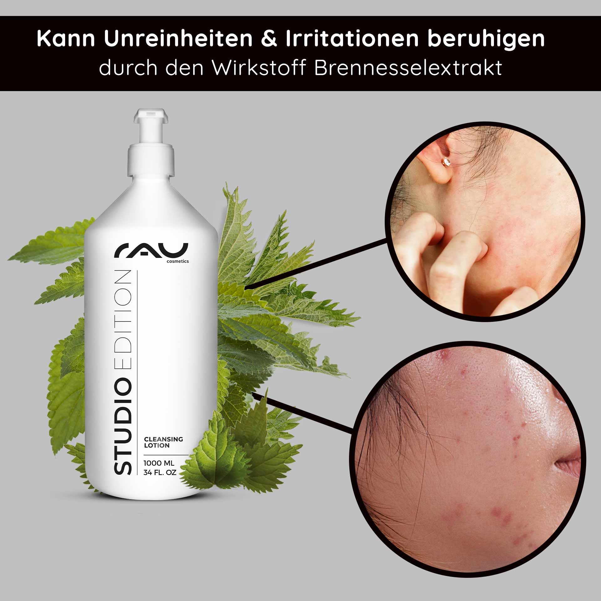 Cleansing Lotion 1000 ml gründliche Reinigunglotion Reinigungslotion-Flasche von RAU Cosmetics mit Brennnessel-Extrakt, umgeben von Brennnesselblättern, die die Vorteile zur Beruhigung von Hautirritationen und Unreinheiten hervorhebt und die natürliche Hautpflege betont.