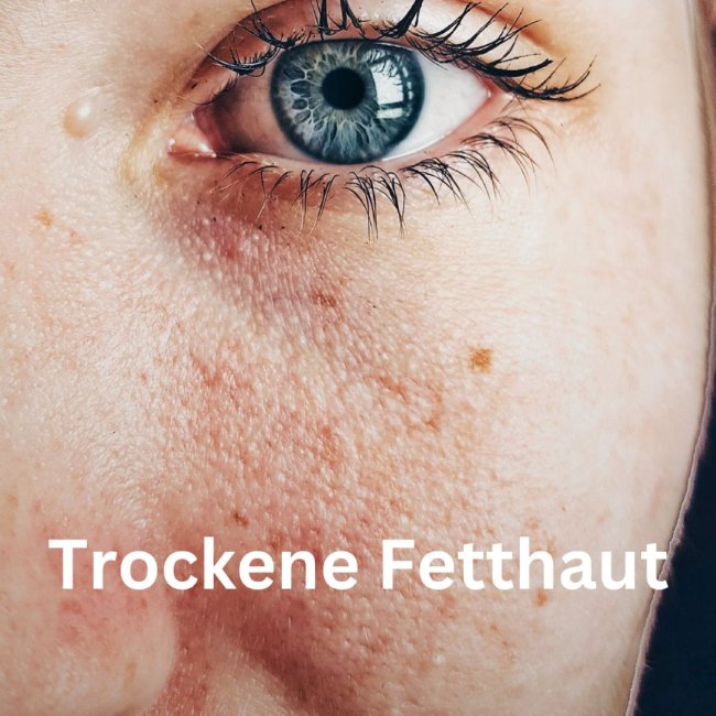 Alles ber trockene Fetthaut: Ursachen, Pflege & Tipps