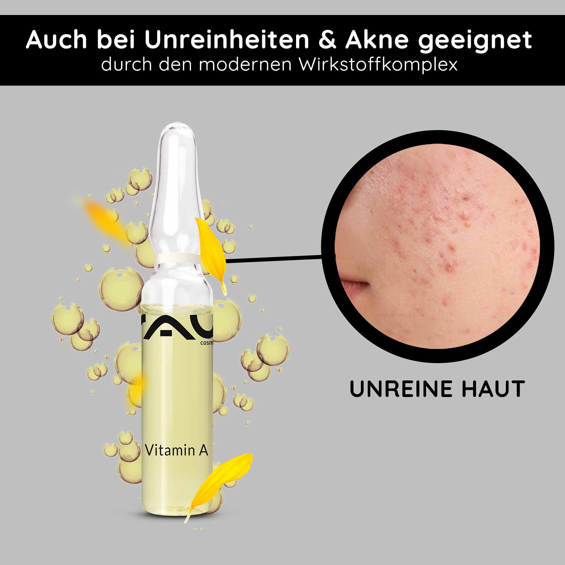 Ampulle mit Vitamin A von RAU Cosmetics, umgeben von Blasen, hervorgehoben für die Behandlung von unreiner Haut und Akne, mit dem Text "UNREINE HAUT" und gelben Blütenblättern.