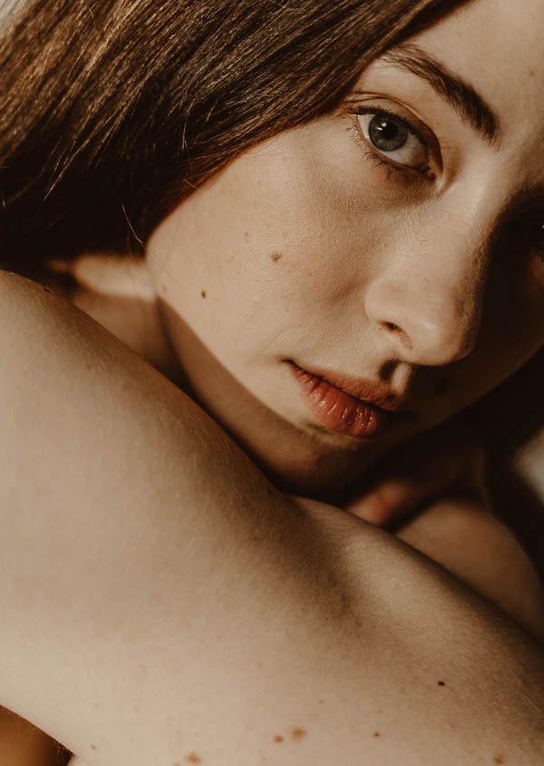 Erstverschlimmerung_Wirkstoffkosmetik_RAU-Cosmetics