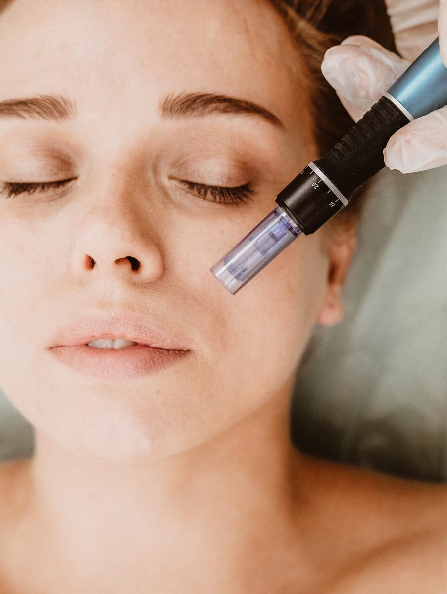 microneedling-darauf-solltest-du-achten Frau mit geschlossenen Augen, während ein Dermapen für Microneedling auf ihre Haut angewendet wird, um Hautverjüngung und Kollagenproduktion zu fördern.