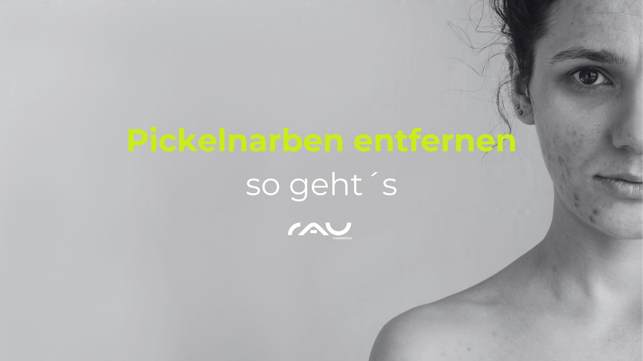 Pickelnarben entfernen - so gehts Frau mit Akne-Narben und Text "Pickelnarben entfernen so geht's", RAU Cosmetics Logo, Hautpflege.