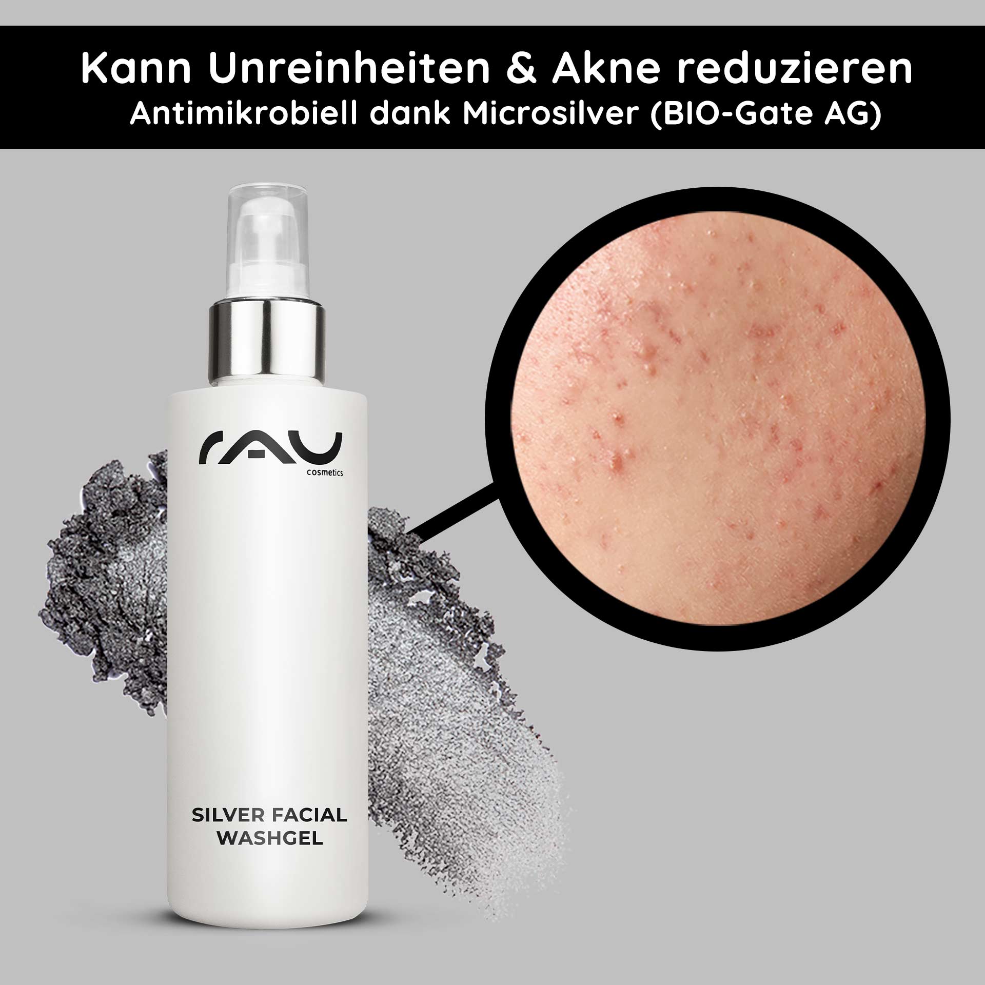 Silver Facial Washgel 200 ml Microsilber Reiniger Flasche RAU Silver Facial Washgel mit antimikrobiellem Mikrosilber, Nahaufnahme von Haut mit Akne und Unreinheiten, mit Hervorhebung der Vorteile für empfindliche und zu Akne neigende Haut.