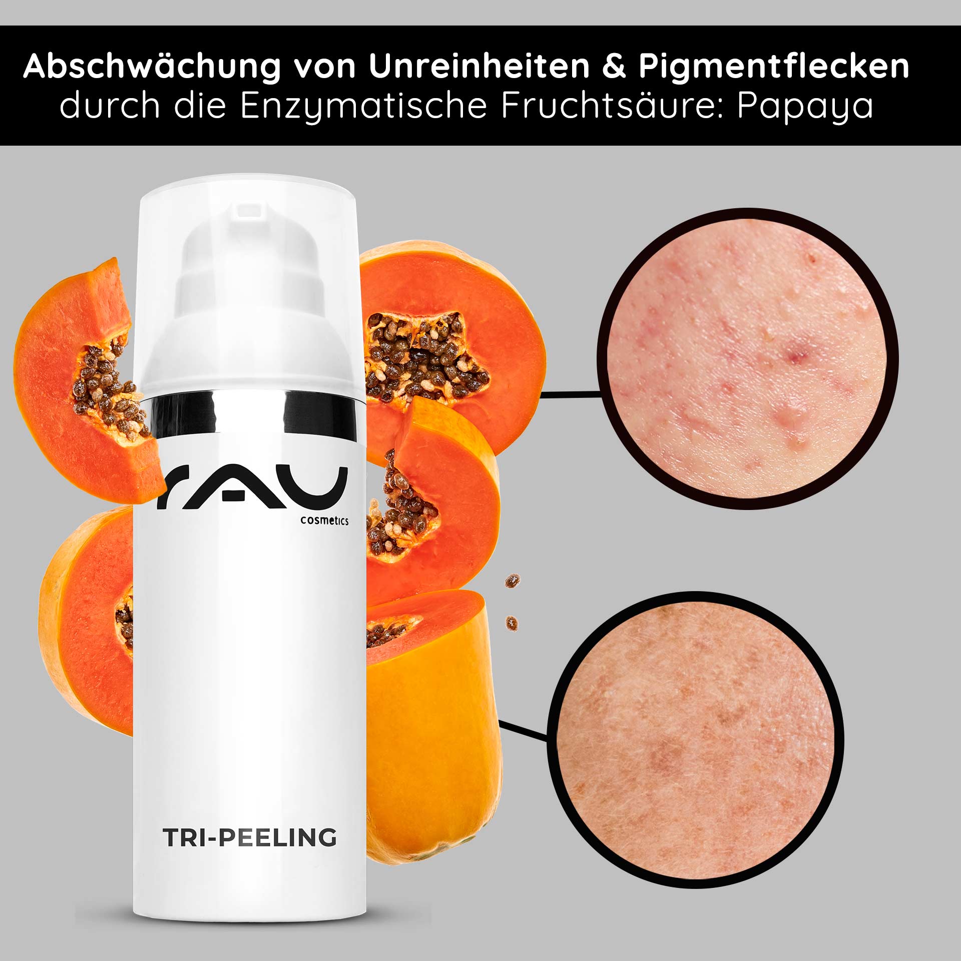 Tri-Peeling 50 ml Enzym- & Fruchtsäurepeeling Das Tri-Peeling-Produkt von RAU Cosmetics mit Papaya zeigt Vorteile bei der Reduzierung von Unreinheiten und Pigmentierung und zeigt Nahaufnahmen der Hautstrukturen, die die Ergebnisse hervorheben.