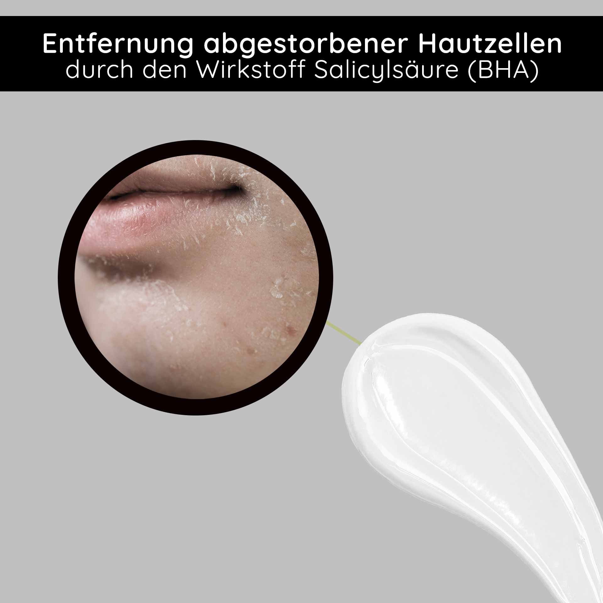Fruit Acid Cream 200 ml  BHA Fruchtsäurecreme Entfernung abgestorbener Hautzellen durch Salicylsäure (BHA) mit Fokus auf Hautpflege und Peeling-Effekte.