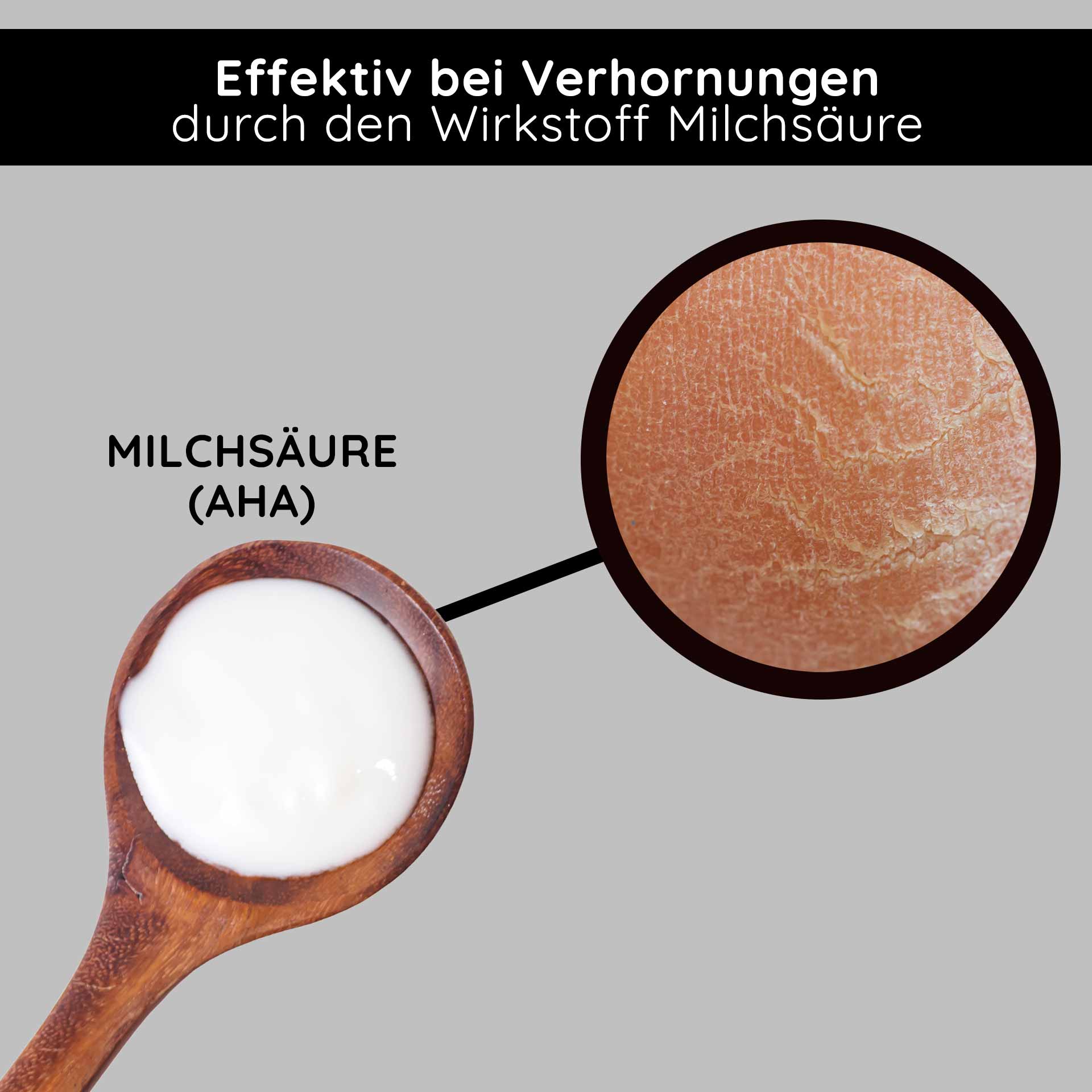 Fruit Acid & BHA Cream 50 ml - BHA Fruit Acid Cream Milchsäure (AHA) in einem Holzlöffel, wirksam gegen Verhornungen, mit Hauttextur im Detail.