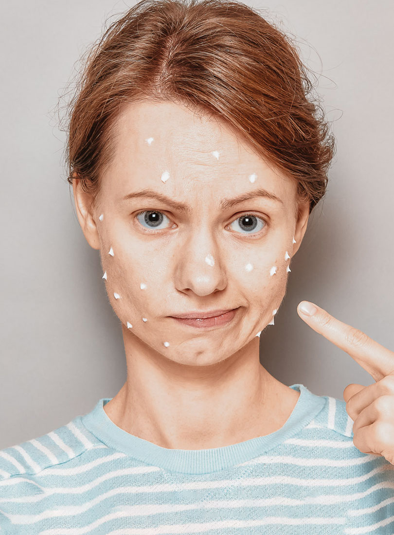Hautpflege-Mythen_Gesichtspflege-Mythos-Pickel-Zahnpasta