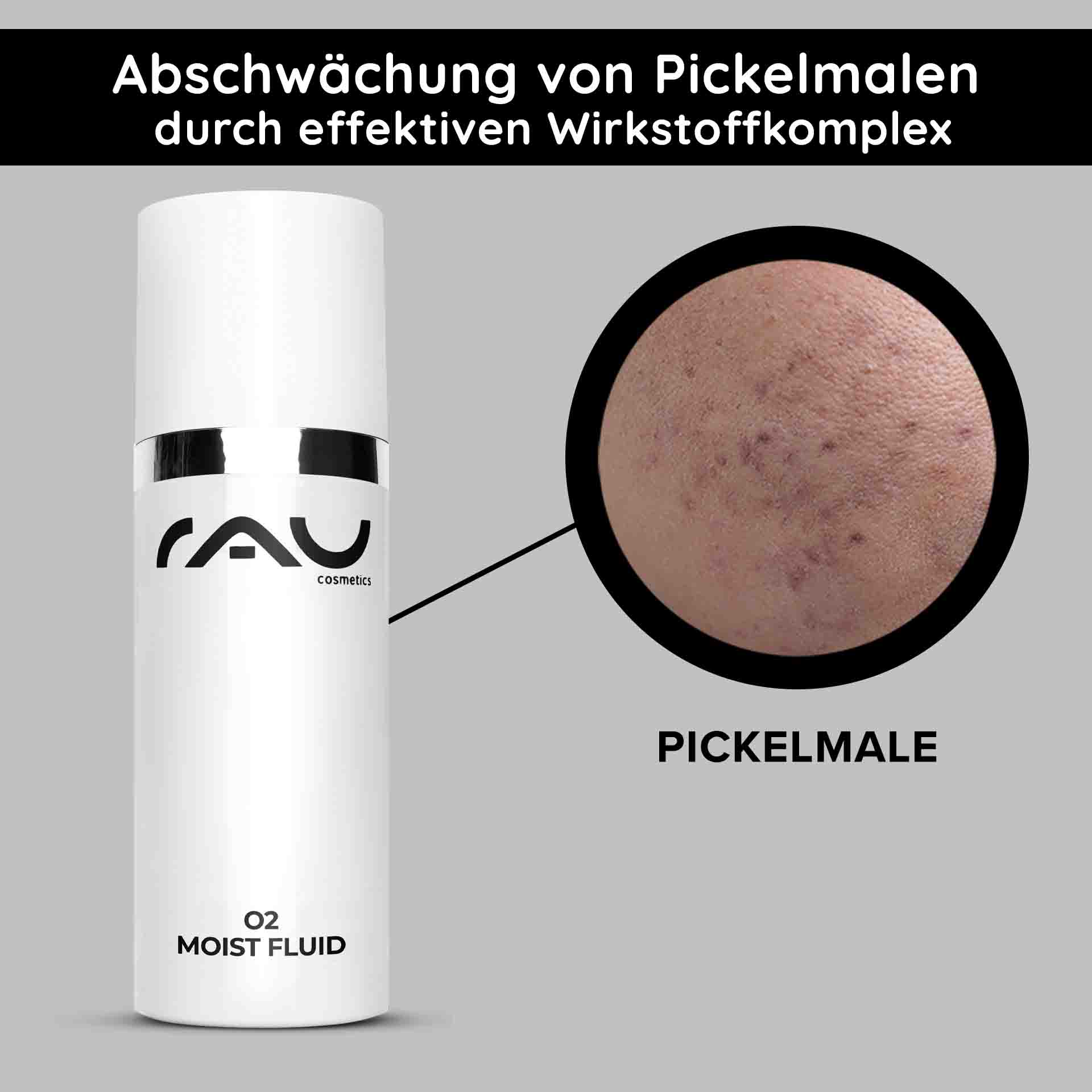 RAU O2 Moist Fluid 50 ml - leichte Tagescreme bei fahlem Teint RAU O2 Moist Fluid Hautpflegeprodukt mit sichtbarem Etikett und Nahaufnahme der Haut mit Aknenarben, wobei die Vorteile für fahle Haut und die Aknebehandlung hervorgehoben werden.