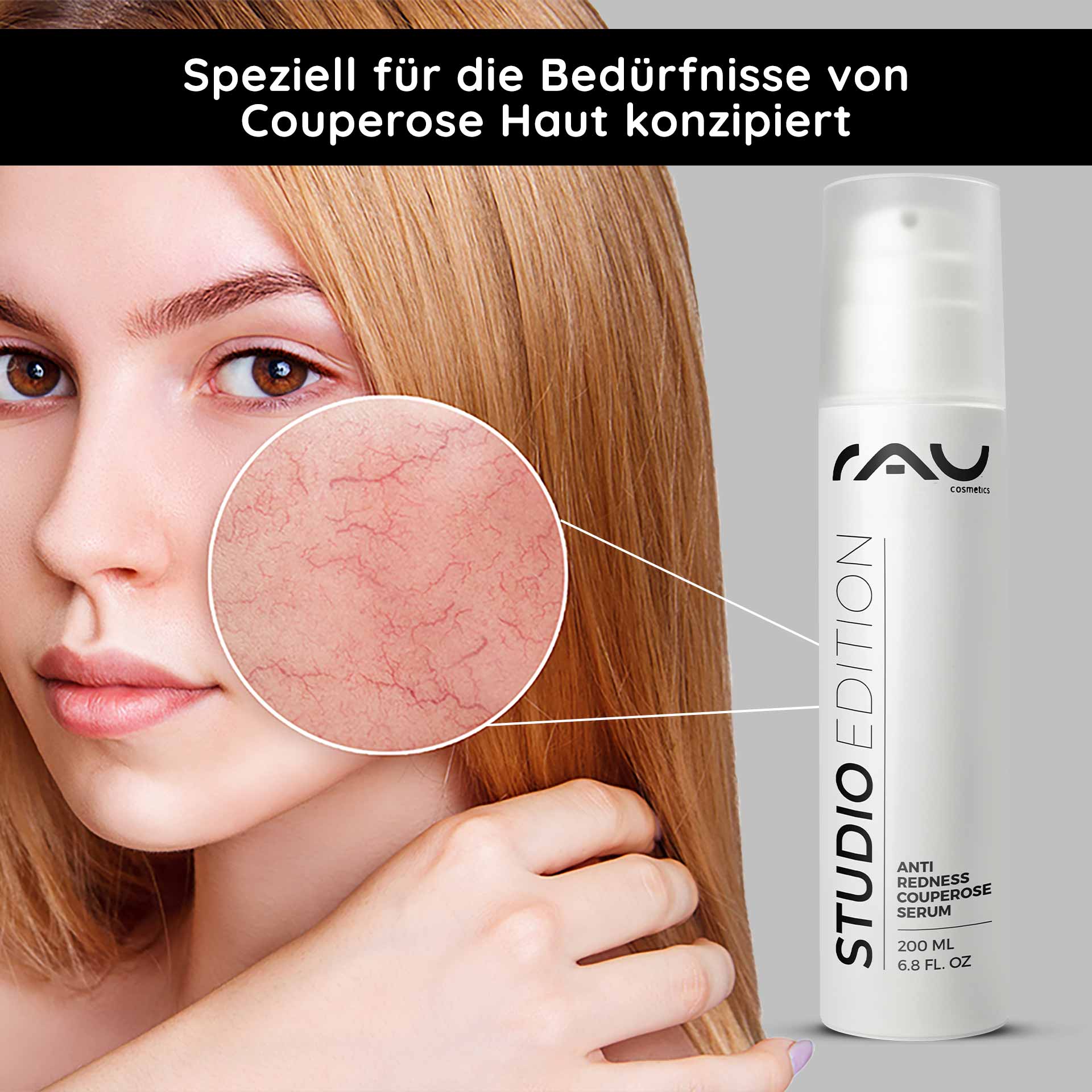 Anti Redness Couperose Serum 200 ml bei Rosacea Anti-Redness Couperose Serum von RAU Cosmetics, entwickelt für empfindliche Haut, hebt Rötungen im Wangenbereich hervor, mit einer Produktflasche mit 200 ml Fassungsvermögen.