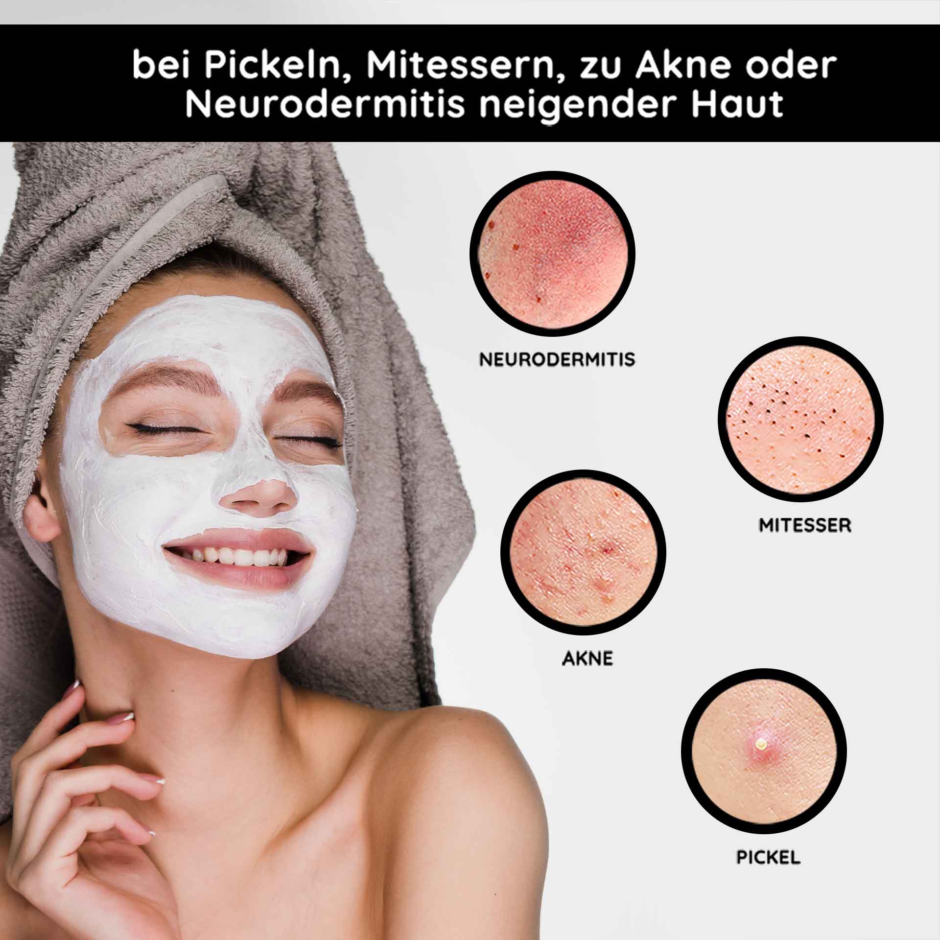 Mineral Mask 50 ml Mattierende Gesichtsmaske Lächelnde Frau mit Gesichtsmaske zur Hautpflege, umgeben von Bildern von Hautproblemen wie Akne, Mitessern und Neurodermitis, präsentiert die Vorteile der RAU Cosmetics Mineral Mask für problematische Haut.