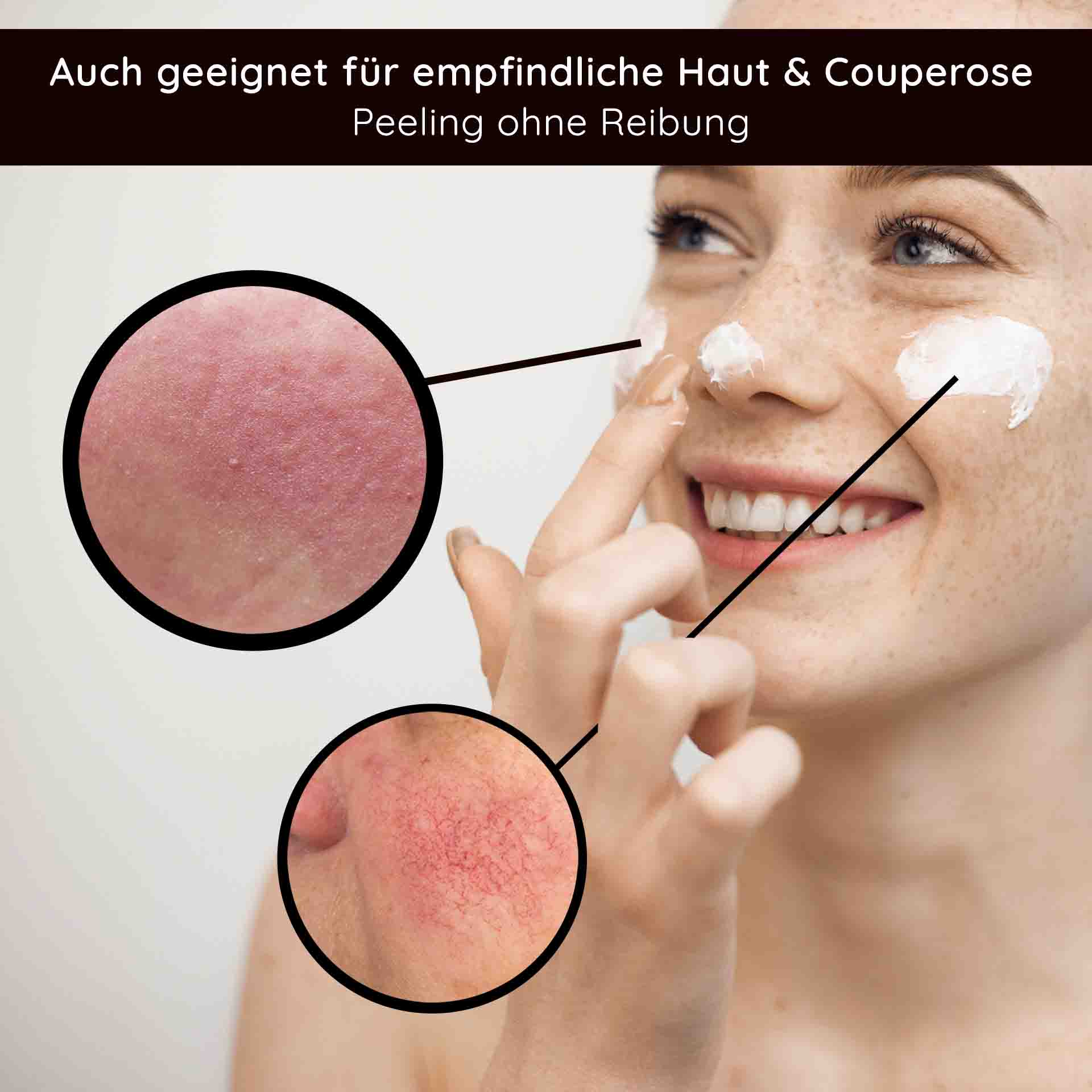 Fruit Acid Peeling 250 ml Fruchtsäurepeeling mit BHA Frau mit freudigem Lächeln, die ein Fruchtsäurepeeling auf das Gesicht aufträgt, mit Nahaufnahmen von empfindlicher Haut und Rötungen, geeignet für empfindliche Haut und Couperose, Peeling ohne Reibung.