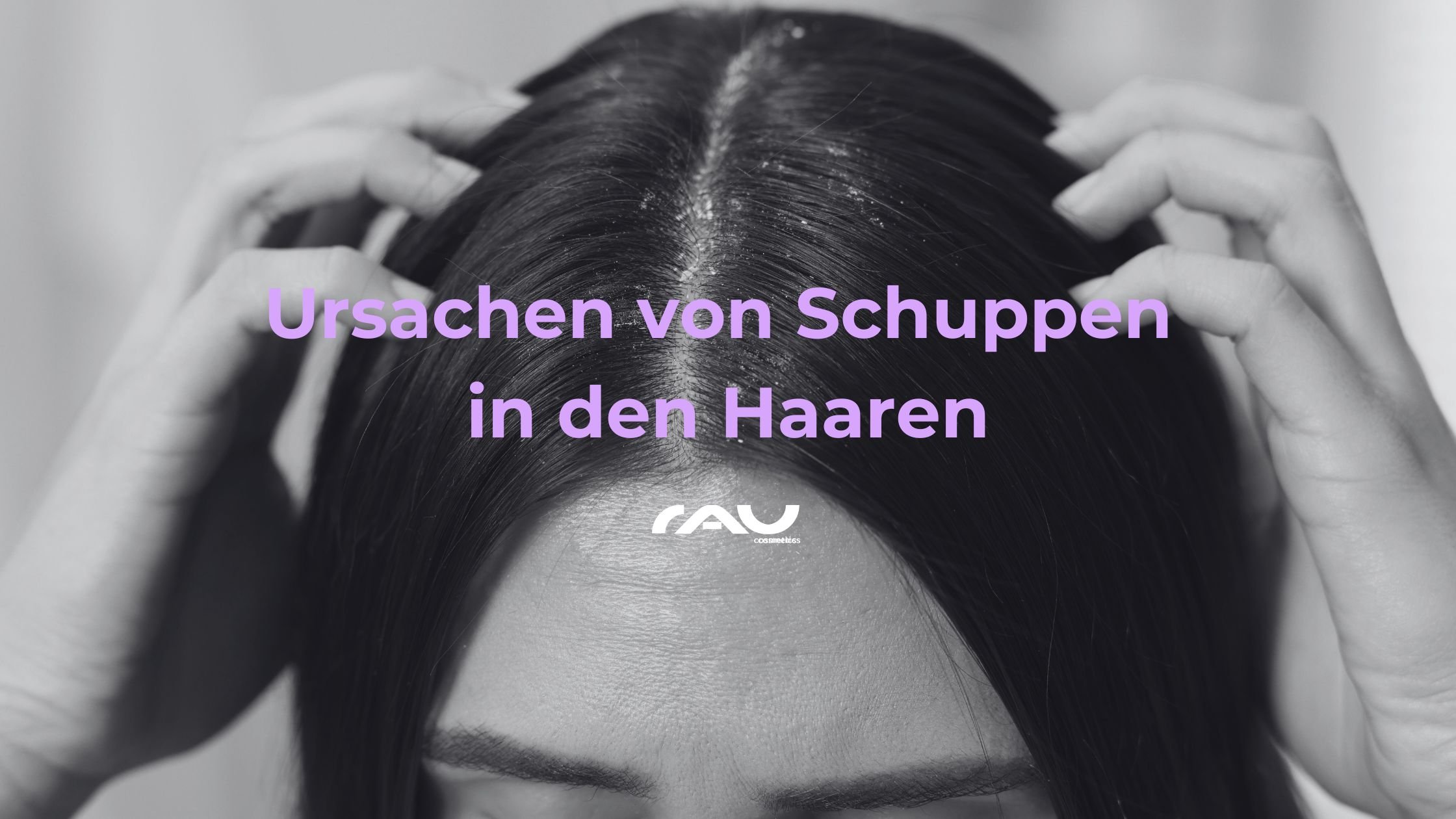 Ursachen von Schuppen in den Haaren, Person mit Händen im Haar, sichtbar trockene Schuppen, RAU Cosmetics Logo.