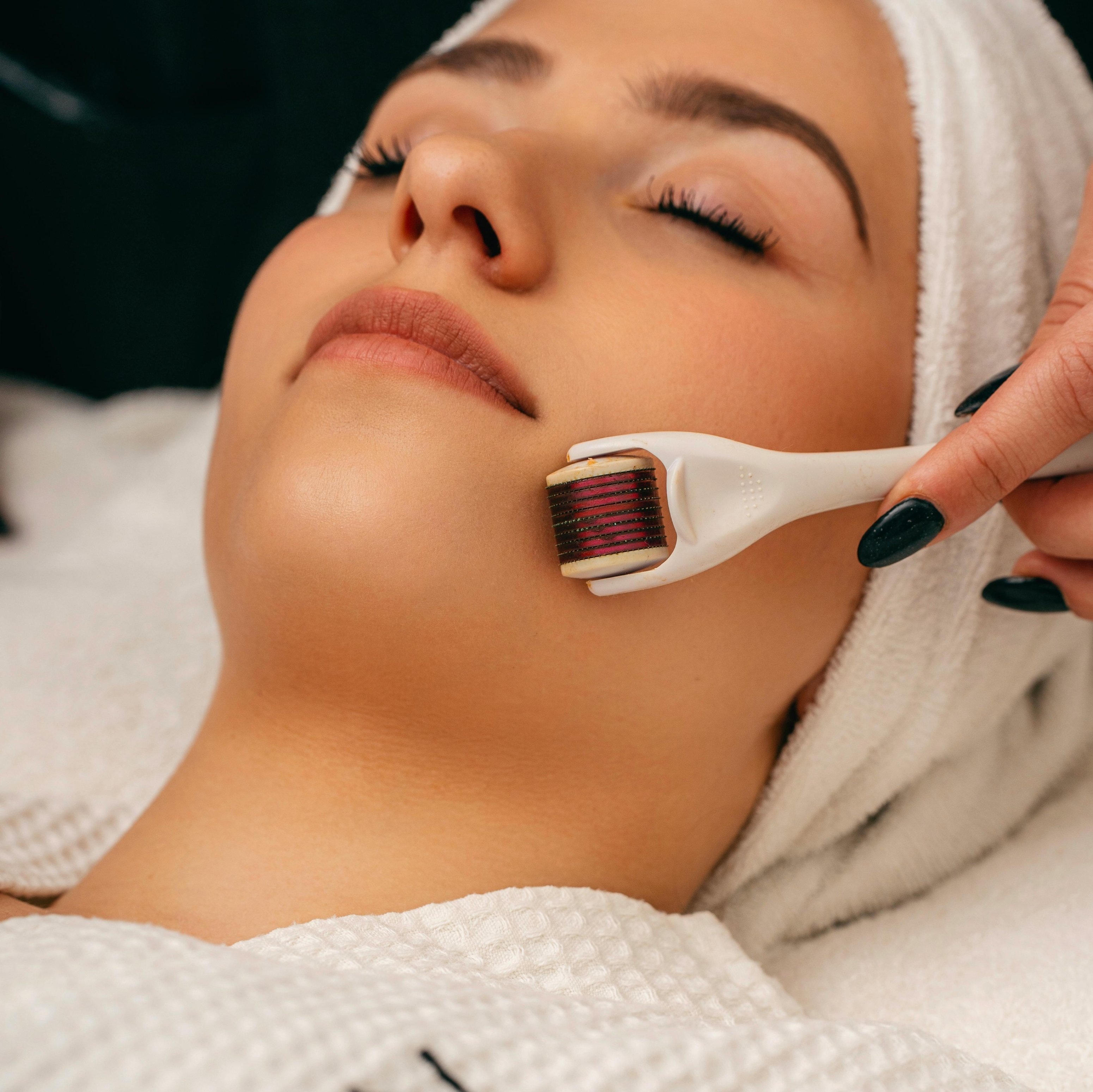 Frau mit Handtuch auf dem Kopf, die eine Dermaroller-Behandlung im Gesicht erhält, zur Verbesserung der Hauttextur und zur Bekämpfung von eingewachsenen Haaren.