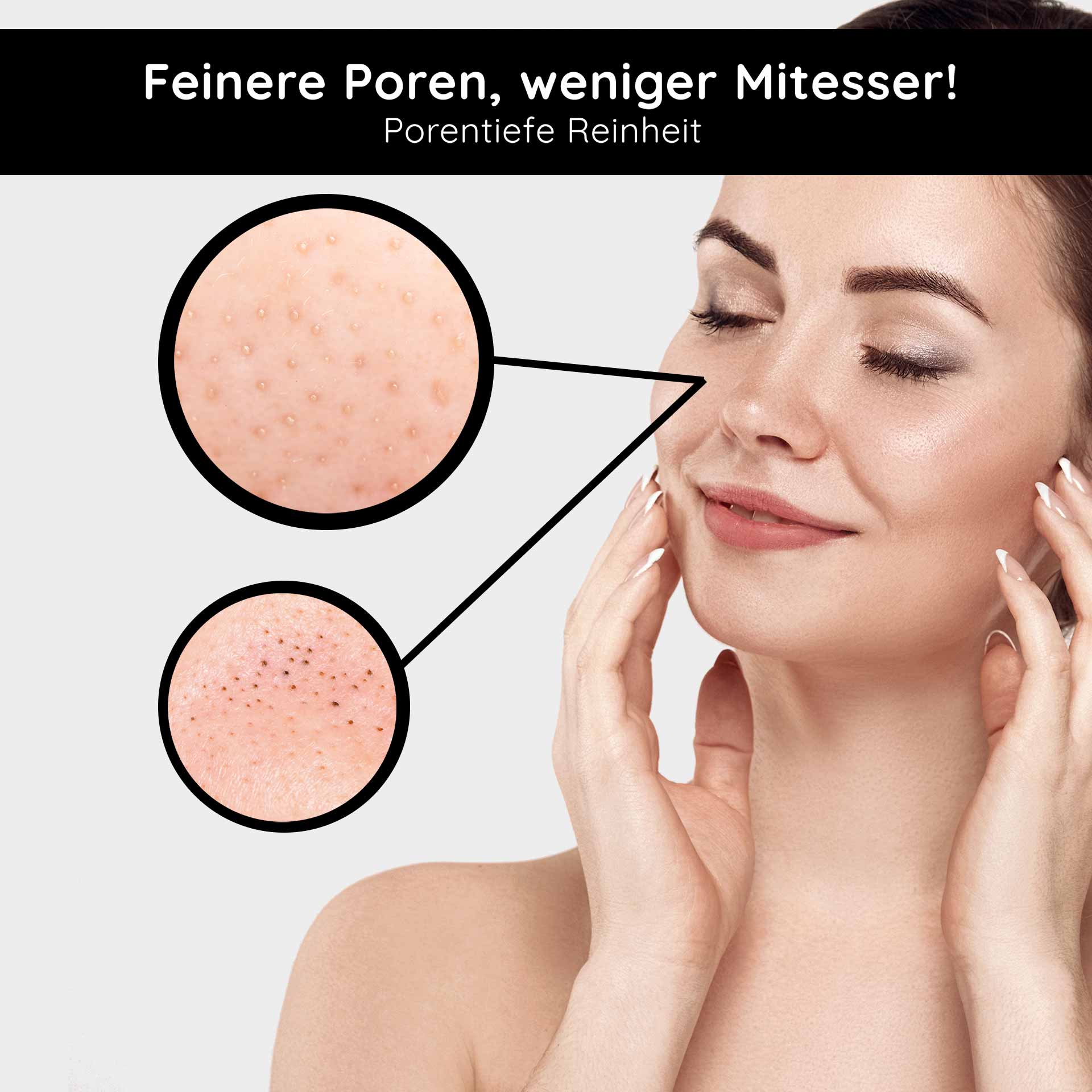 Deep Cleansing 2in1 200 ml 2in1 Gesichtswasser Frau mit sanfter Haut, die Gesichtspflege anwendet; vergrößerte Poren und Mitesser werden hervorgehoben, betont die Vorteile des RAU Cosmetics Deep Cleansing 2in1 Gesichtswassers.