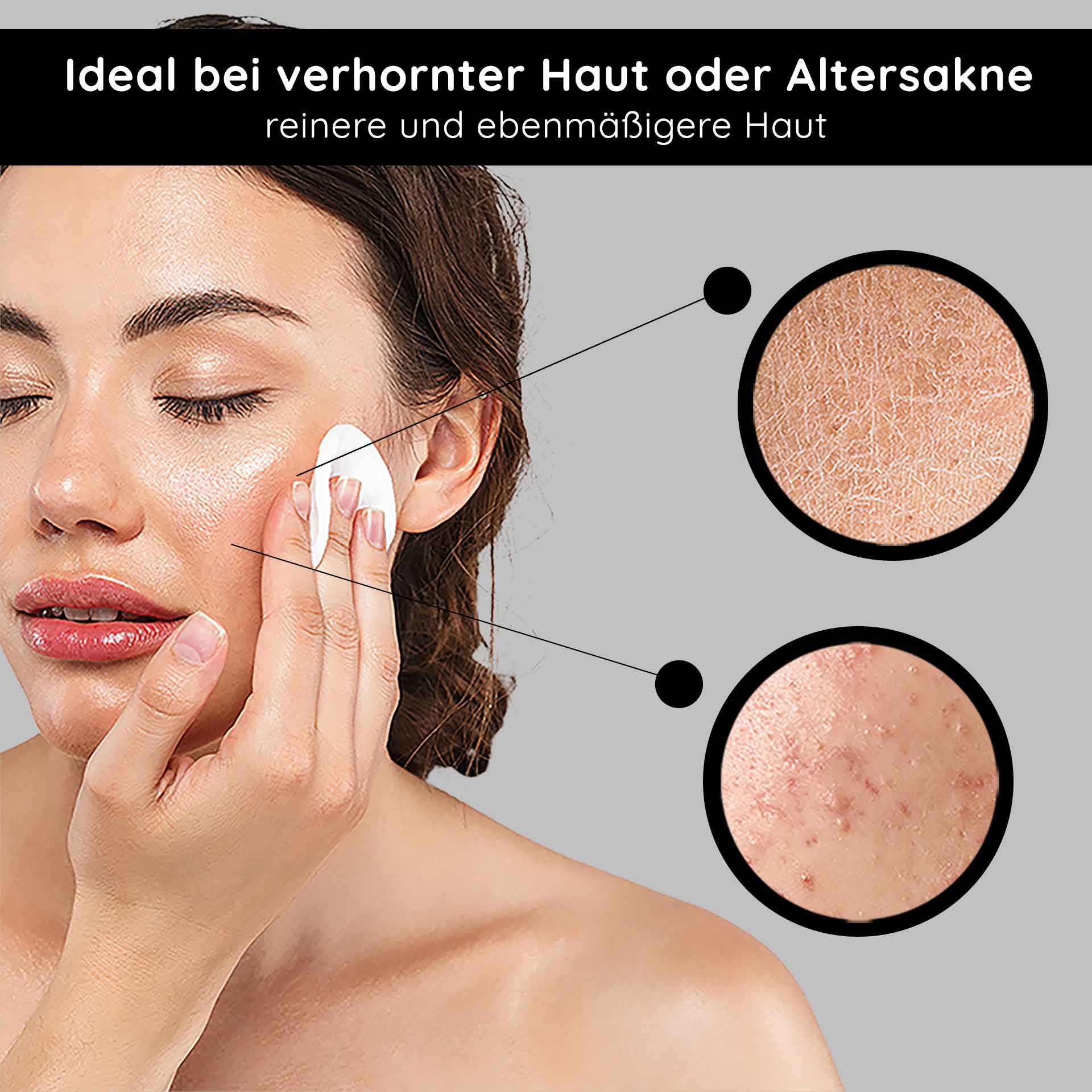 AHA Tonic 1000 ml mild fruit acid tonic Frau mit Wattepad, das AHA Tonic auf Gesicht aufträgt, ideal bei verhornter Haut oder Altersakne, zeigt Hautunreinheiten und Texturverbesserung.