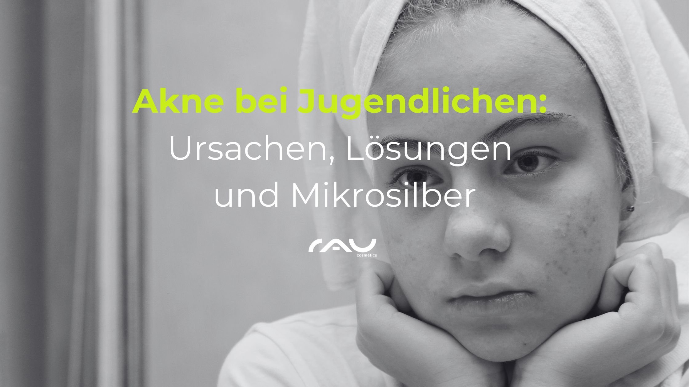 Akne bei Jugendlichen: Junge mit sichtbaren Pickeln und nachdenklichem Ausdruck, betont die Herausforderungen von Akne und Lösungen wie Mikrosilber in der Hautpflege.