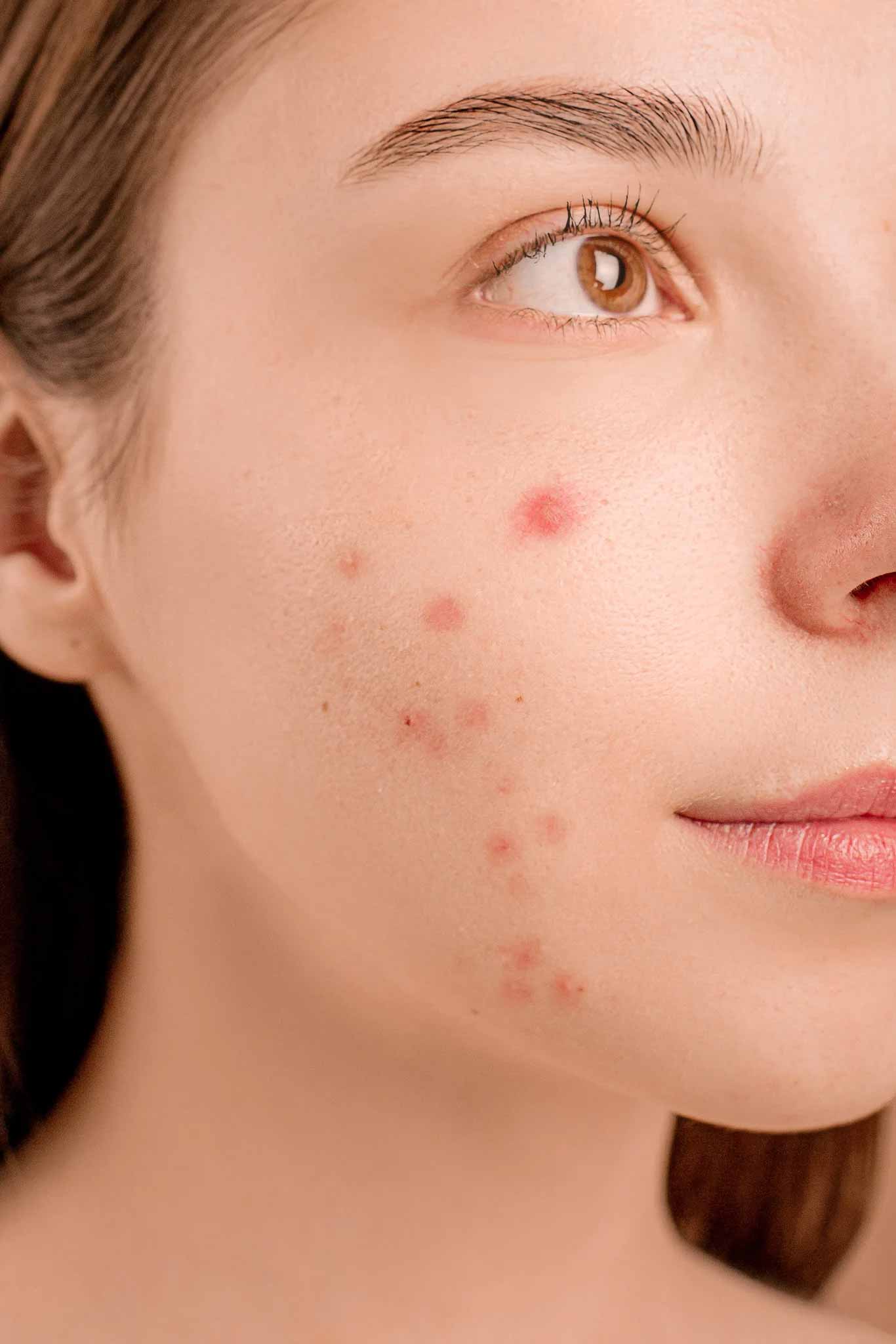 pexels-anna-nekrashevich-6475987-2 pexels-anna-nekrashevich-6475987-2